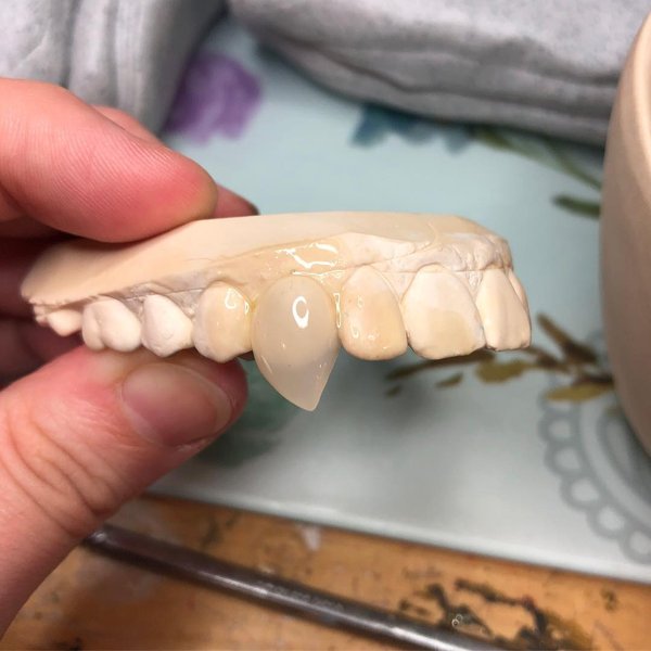 Thumbnail of p-bphlre8ff0u-6f57880e31064ae6 0