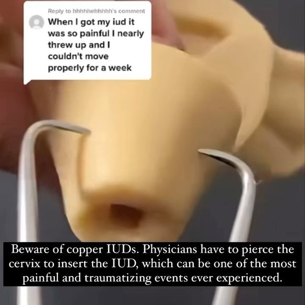 Thumbnail of p-cnx2pauodzj-1b6dfee80f564923 7