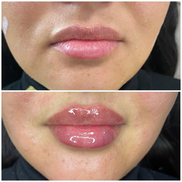 Thumbnail of p-cznp4rzvs3t-235e5940ab544118 0