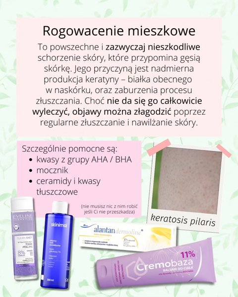 Thumbnail of p-dpmnwwddzb9-23d2c05ba7ef4355 2