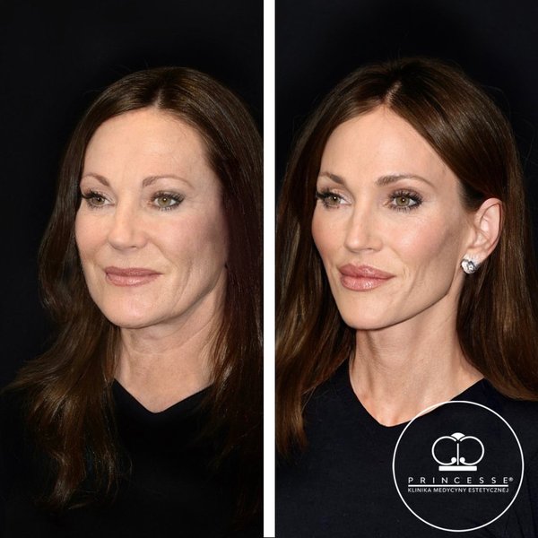 Thumbnail of p-cwaaafskzcc-2fba263baf074e3a 0