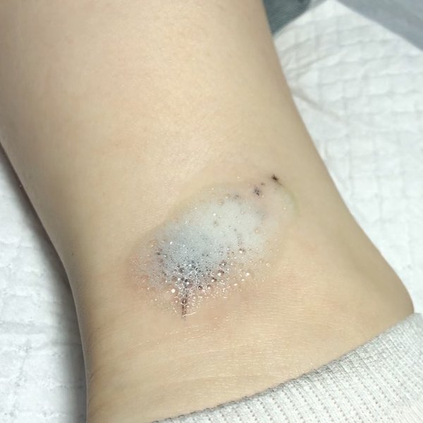 Thumbnail of p-b6rlazmhktt-33600a15e867462a 2