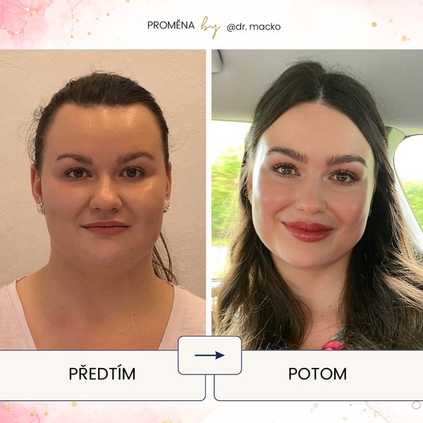 Thumbnail of p-cxx7ojbqehi-3651ee4c51424a43 0