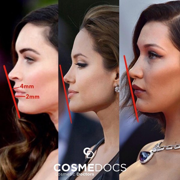 Thumbnail of p-btewucwlr7c-3d41df58ea614ca8 0