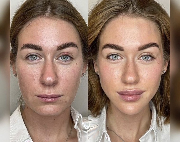 Thumbnail of ytpujg-sd-44981702afff46f6 0