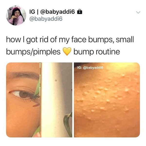 Thumbnail of p-berp27gfn2q-4793b7f156d94920 0