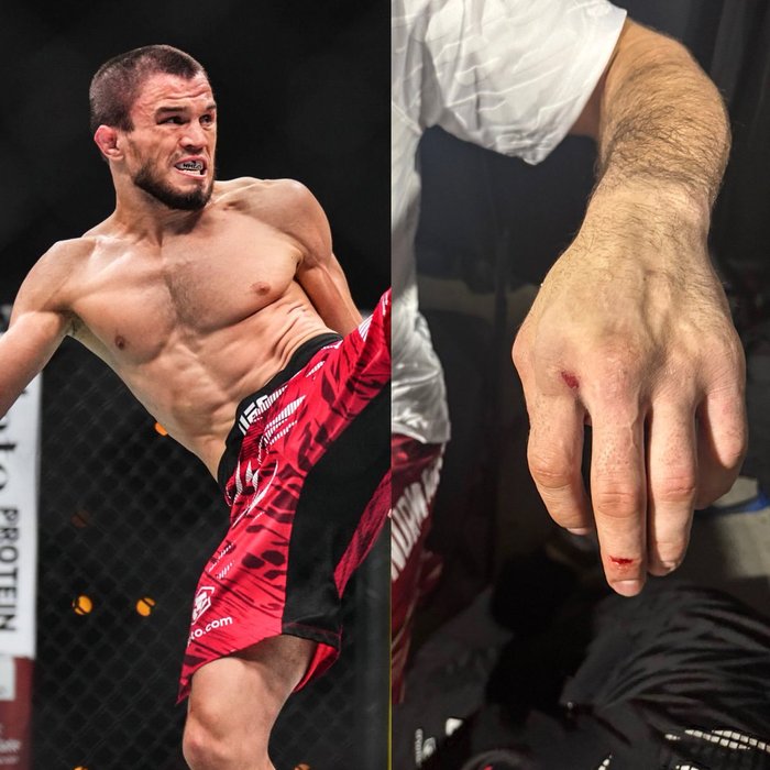 Thumbnail of www-x-com-home-of-fight-status-1880855232512753667-4e1fcab431354738