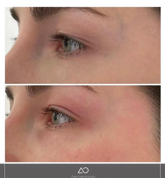 Thumbnail of p-dajz8ykssmk-529ca66c3aeb41f4 0