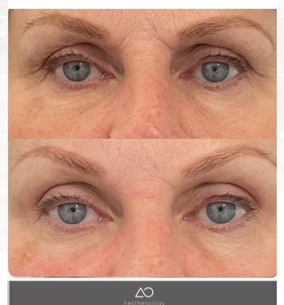 Thumbnail of p-dajz8ykssmk-529ca66c3aeb41f4 1