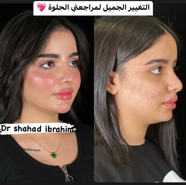 Thumbnail of p-cr4jnq6qauq-577cfb8097c6454a 0