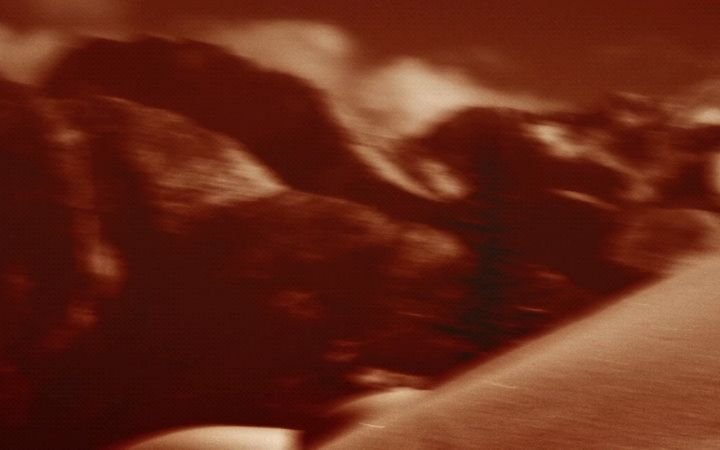 Thumbnail of p-ddagnkbsqcj-73702c4c709f4f2b 4
