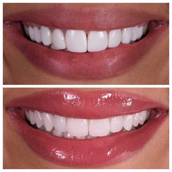 Thumbnail of p-bbbzt5adhpw-81c1db3dd9914cef 0