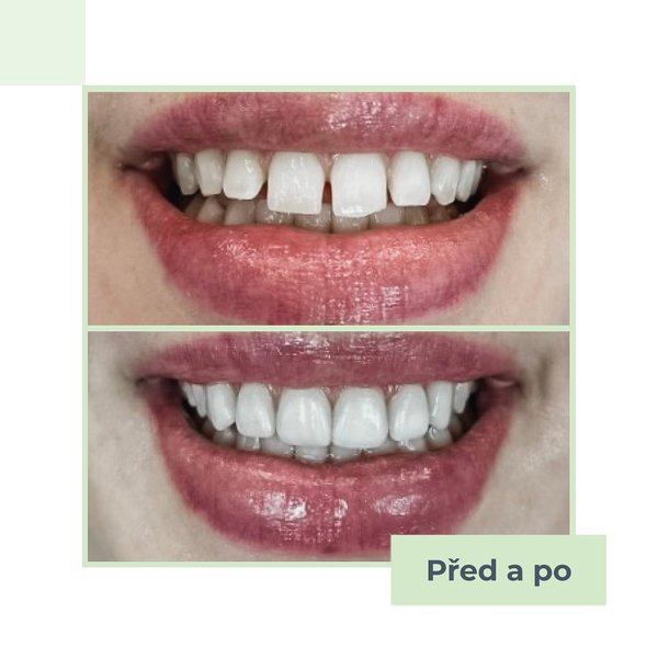 Thumbnail of p-crabx6jss8h-81df51071f594f66 0