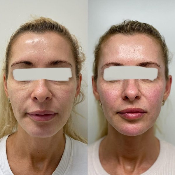 Thumbnail of p-cpsapqbdhfd-86d57c9d98bc412d 0