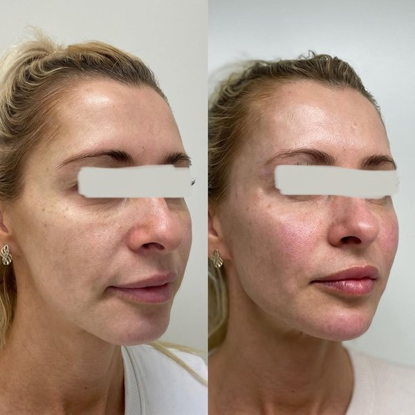 Thumbnail of p-cpsapqbdhfd-86d57c9d98bc412d 1