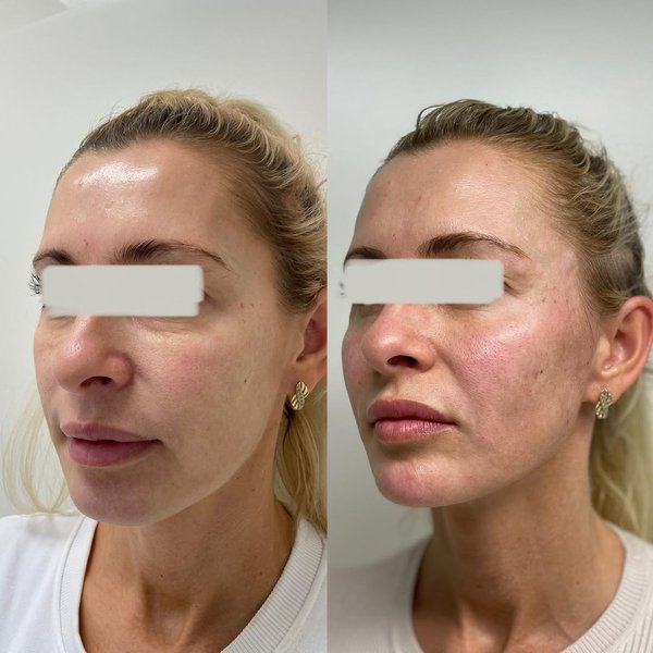 Thumbnail of p-cpsapqbdhfd-86d57c9d98bc412d 2