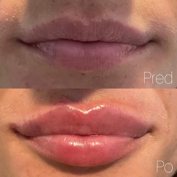 Thumbnail of p-cr4im0qrcqi-88081b82471f4d3a 1