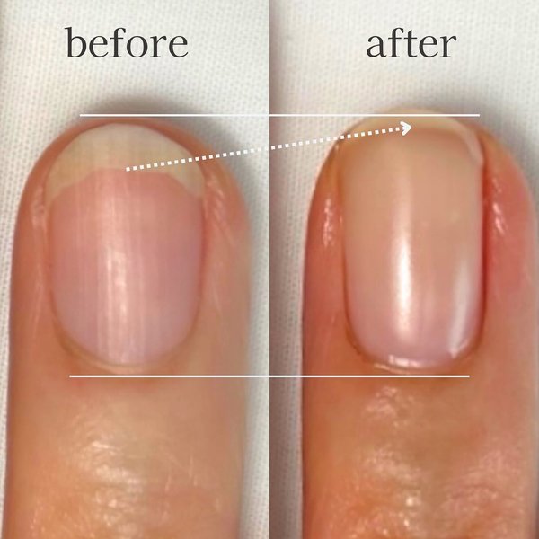 Thumbnail of p-dawnqvut1k-8a985cba6cc04879 0