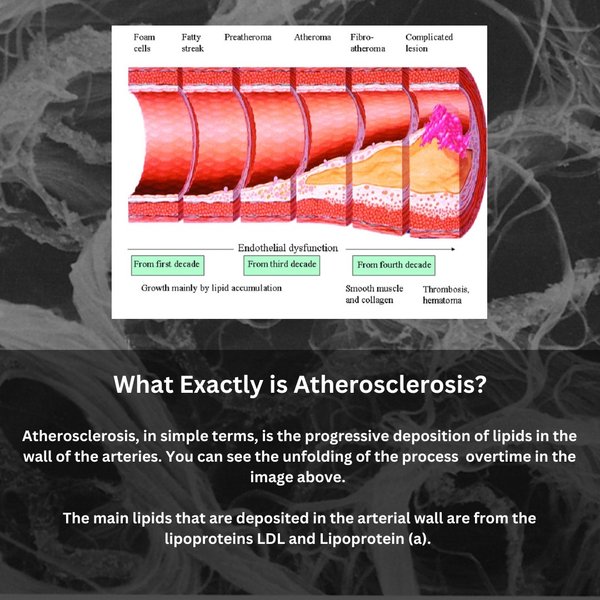 Thumbnail of ct-uvqzox13-947eedd95fbb45a4 2