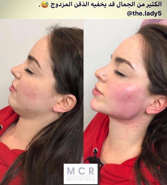 Thumbnail of p-cj6ferwq3pv-9f69ec6fee8c4719 0