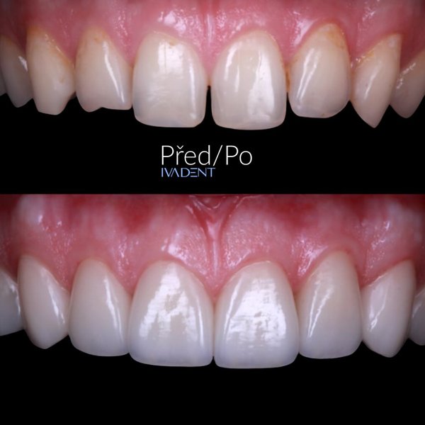 Thumbnail of p-dagczw0salw-a2bf38f6ee144a01 0