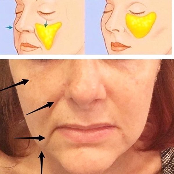 Thumbnail of p-byx3vtxbgy-a8b98e3570a04fe6 0