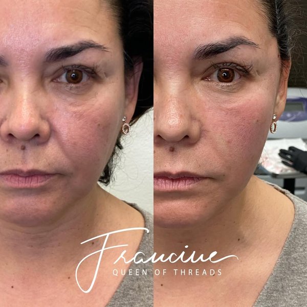 Thumbnail of p-ckvq7wgjfut-a9383a6ad0314735 0