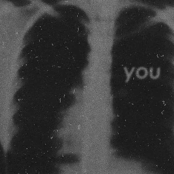 Thumbnail of p-c7pnuesns5y-abc33a63ac5b4e59 5