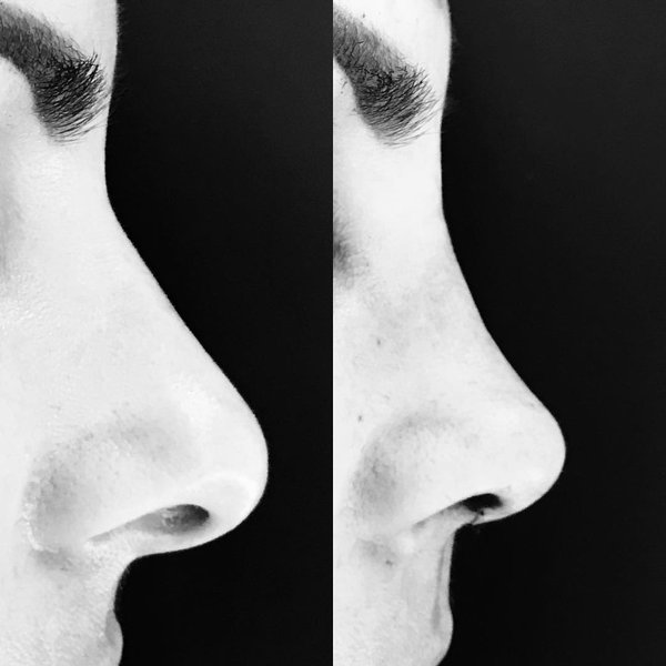 Thumbnail of p-bafdadelnz0-af16a11c7b104f69 0