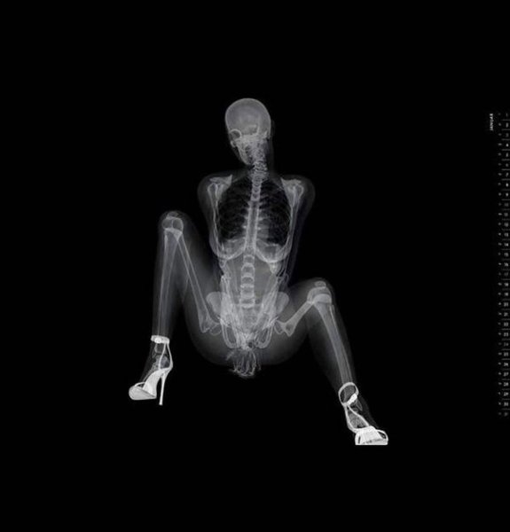 Thumbnail of p-ch0dk30pzct-b44bc2f52010403f 1