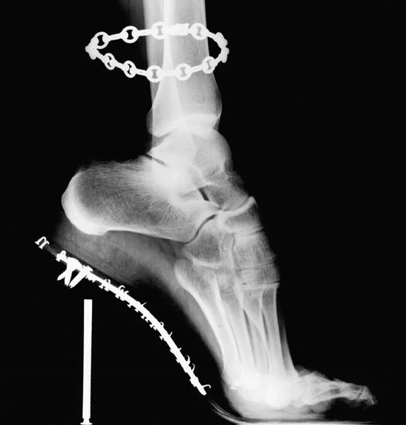 Thumbnail of p-ch0dk30pzct-b44bc2f52010403f 2