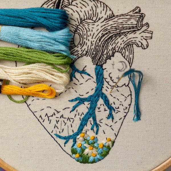 Thumbnail of p-cnvasy7lepp-c12d1463a7144574 5