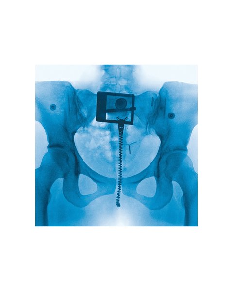 Thumbnail of p-dlh7alus0na-cc8623f1325b41b2 0