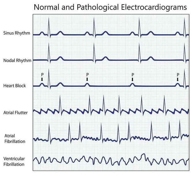 Thumbnail of p-bs0lv6qbqa3-d446516167354610 0