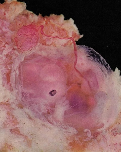 Thumbnail of www-instagram-com-p-dqn1dredqe8 1