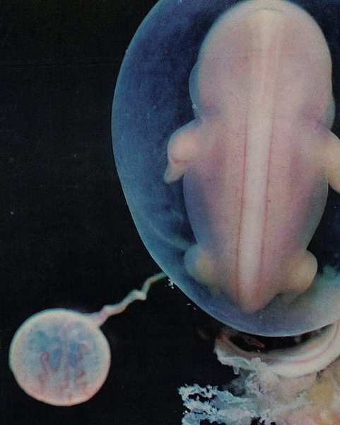 Thumbnail of www-instagram-com-p-dqn1dredqe8 2