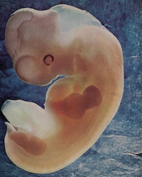 Thumbnail of www-instagram-com-p-dqn1dredqe8 3