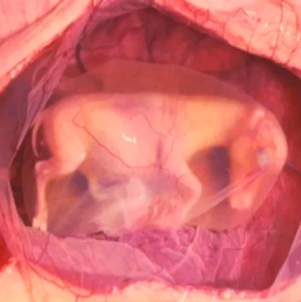 Thumbnail of p-cssssxmnbxq-ea0f8cd339ac48f3 0