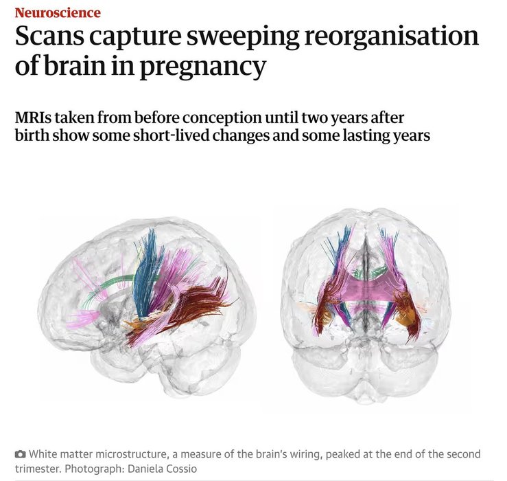 Thumbnail of www-x-com-iterintellectus-status-1836109506486714622-f27e4b1c4adf45b0
