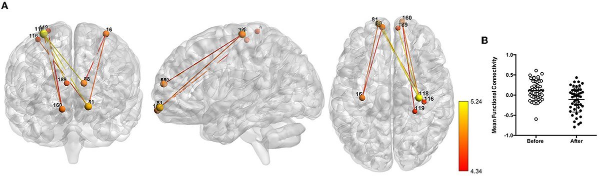 Thumbnail of www-x-com-ntfabiano-status-1805569365326106882-0141b6362ffa4790
