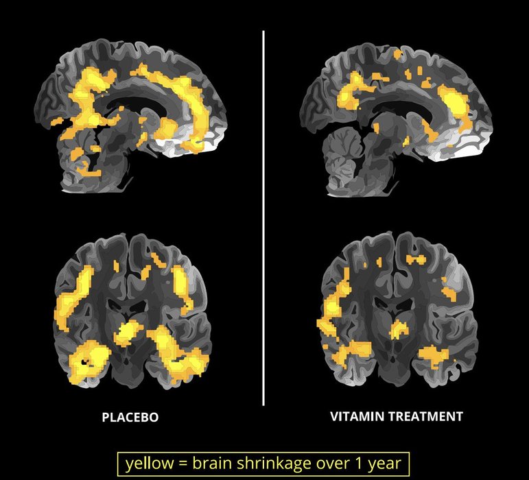 Thumbnail of www-x-com-danmurrays-status-1790381633448673438-232d0a2cf62d435e