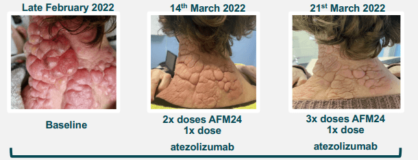 Thumbnail of www-x-com-jfais20-status-1640089734432149504-2b2c78c264a04a3c