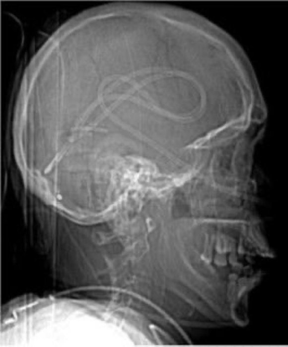 Thumbnail of www-x-com-drkeithsiau-status-1955756052160393259-2f61b400ea3b4d2d