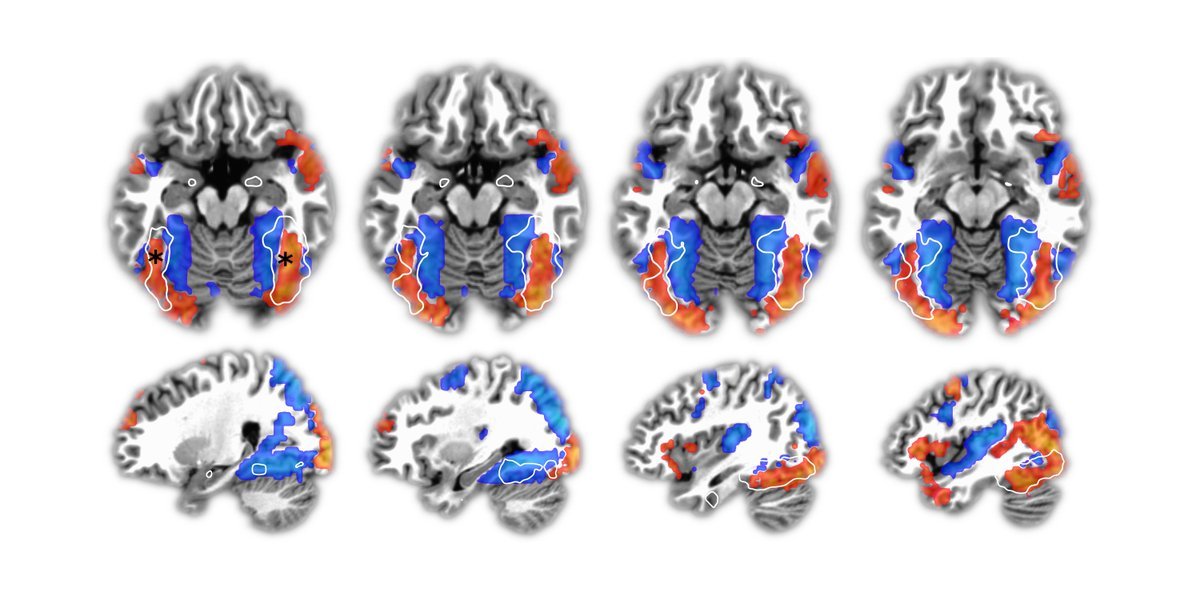 Thumbnail of www-x-com-thelablab-status-1384642299087491073-3b69e1f0a3b74193