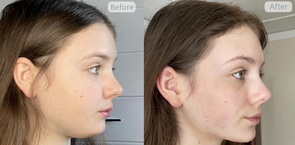 Thumbnail of www-x-com-milky-raw-status-1877102903632212353-6380aac461814caa