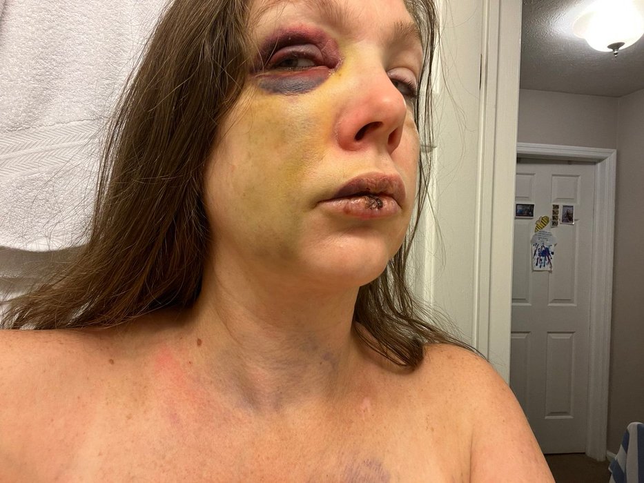 Thumbnail of www-x-com-berniemoreno-status-1950687476529689034-6fc436c527164c63