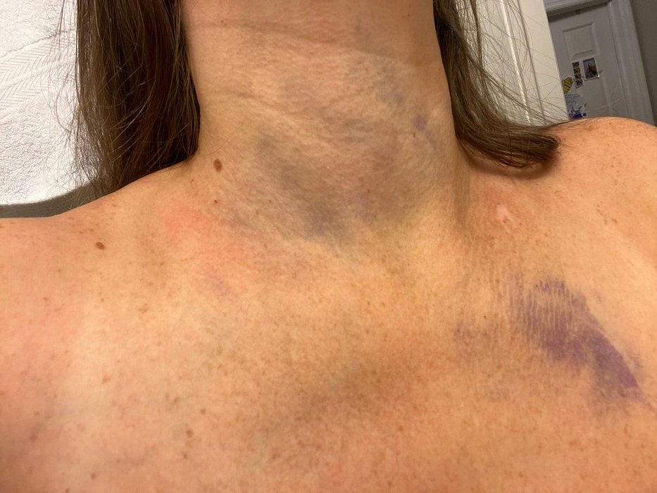 Thumbnail of www-x-com-berniemoreno-status-1950687476529689034-6fc436c527164c63