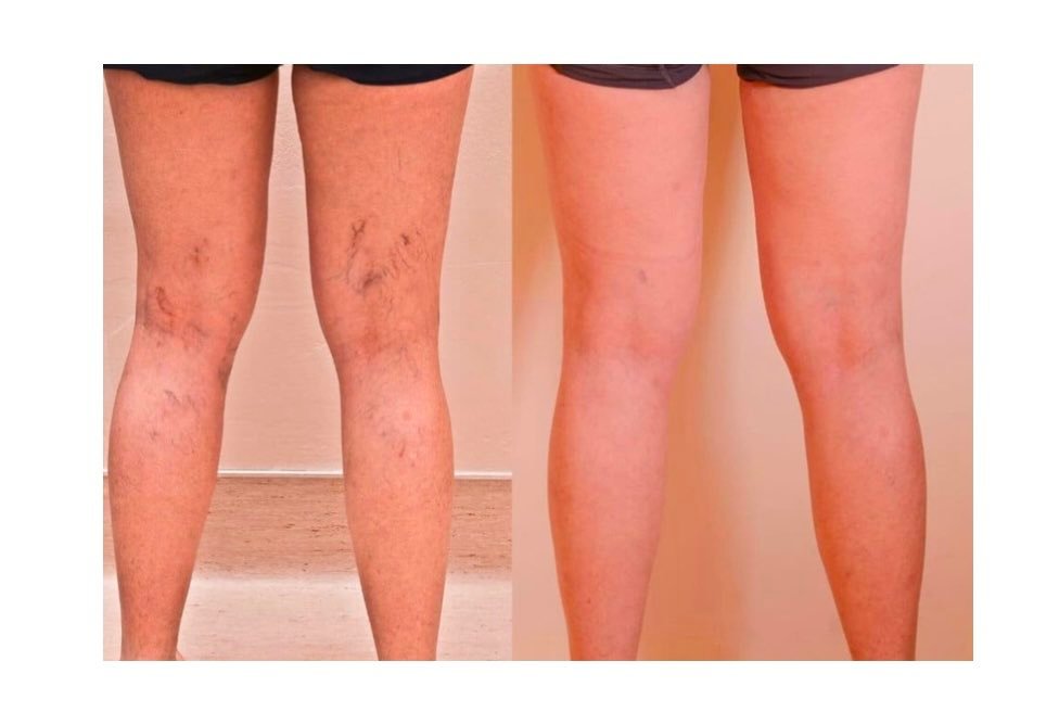 Thumbnail of www-x-com-vitallymelanie-status-1891928209056309453-86956b5b3b4b4b49