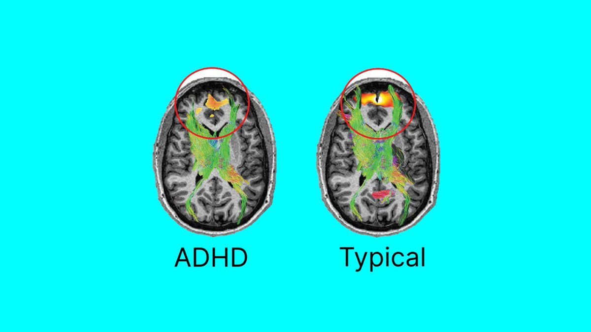 Thumbnail of www-x-com-andrewhopper-status-1934596909425107085-8fc18d0cb9c94841