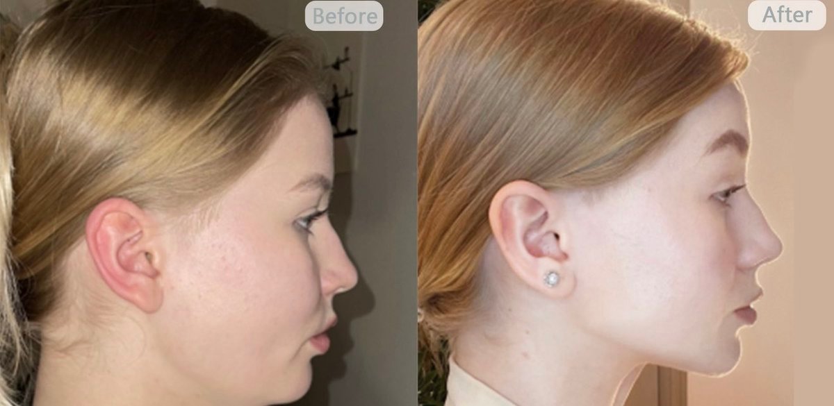 Thumbnail of www-x-com-milky-raw-status-1877101876568596907-af25ddcfd0564768